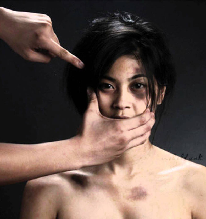 Exposure to childhood violence is linked to psychiatric disorders (File Photo)